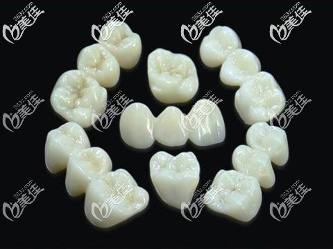 成都東籬醫(yī)院愛爾創(chuàng)全瓷牙