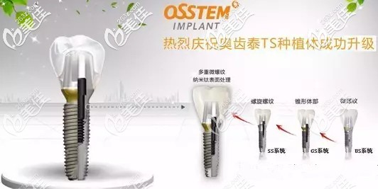 奧齒泰osstem ts3植體系列 奧齒泰osstem ts3植體系列