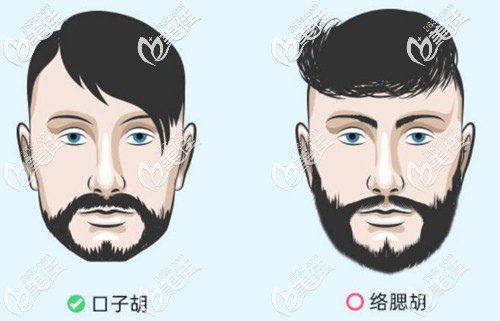 擅長口子胡種植和絡(luò)腮胡種植 擅長口子胡種植和絡(luò)腮胡種植