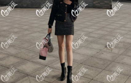 我想我比較有資格回答青島哪家整形醫(yī)院大腿吸脂手術(shù)好吧，畢竟順利恢復(fù)42天了