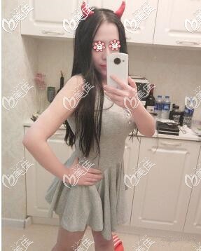 新疆黎美腰腹水動力吸脂3個月