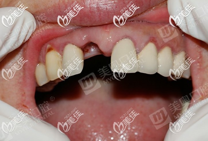 趁活動在蘇州美奧<span style= 趁活動在蘇州美奧<span style=