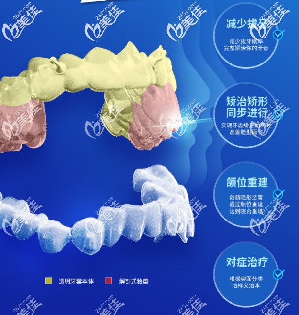正雅隱形矯正有這些好處 正雅隱形矯正有這些好處