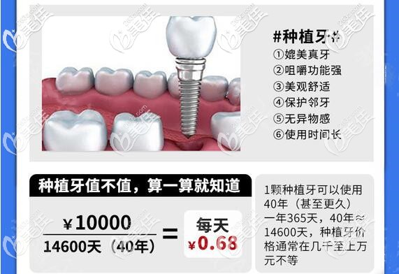 成都極光口腔種植牙收費(fèi)價(jià)格貴嗎