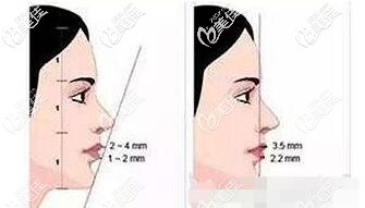 自我判斷是不是凸嘴的方法