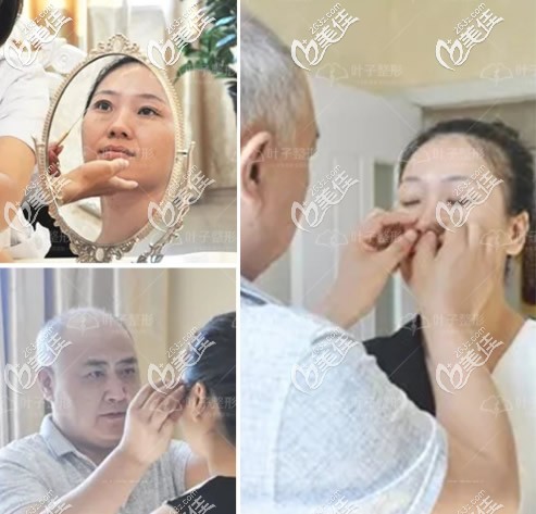 包頭葉子整形醫(yī)院張會(huì)堂院長隆鼻前面診 包頭葉子整形醫(yī)院張會(huì)堂院長隆鼻前面診