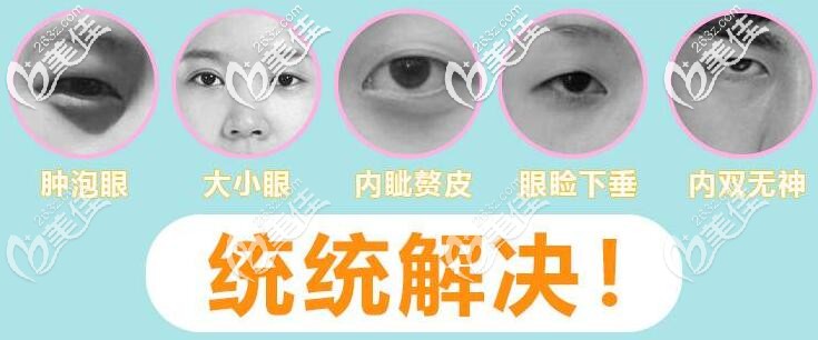 芭比眼綜合可改善多種眼部問題 芭比眼綜合可改善多種眼部問題