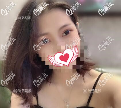 絕“袋”佳人：了解到海南祛眼袋哪家醫(yī)院好后90后妹子終于把厚重的眼袋擺脫掉了！