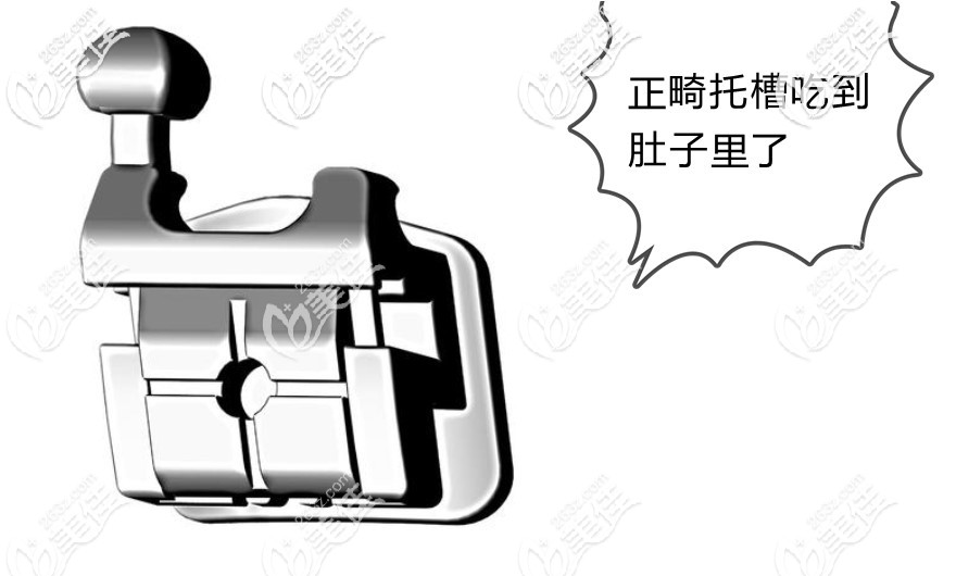 正畸托槽沒粘緊吃肚子里了怎么辦 正畸托槽沒粘緊吃肚子里了怎么辦