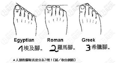 不同的腳型
