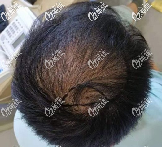 竇云柯醫(yī)生給我畫的設(shè)計(jì)線 竇云柯醫(yī)生給我畫的設(shè)計(jì)線