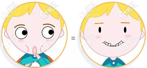 兒童地包天可提前干預(yù)治療 兒童地包天可提前干預(yù)治療