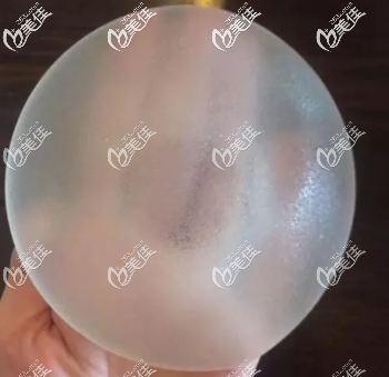 法國(guó)伊思雅隆胸假體優(yōu)缺點(diǎn)