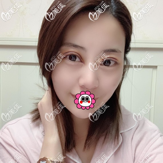 術(shù)后恢復(fù)7天拆線