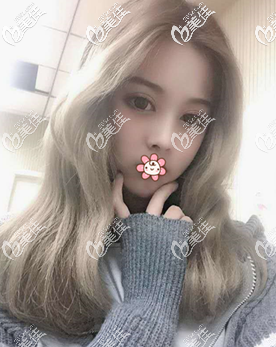 泰國(guó)曼谷雨季做自體脂肪面部填充怎么樣 泰國(guó)曼谷雨季做自體脂肪面部填充怎么樣