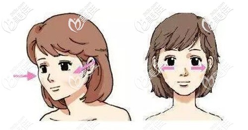 擠壓顴骨兩年并不能降低顴骨