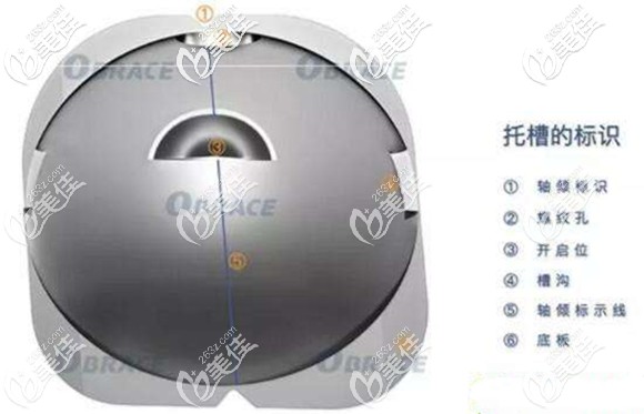 覺得蘇州隱形矯正貴，不如選擇歐睛球面自鎖托槽