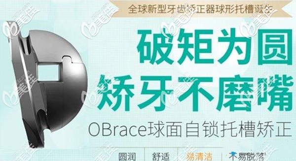 嫌蘇州隱形矯正的價格貴?美奧牙科的歐睛自鎖托槽只要618元起,要不要了解下