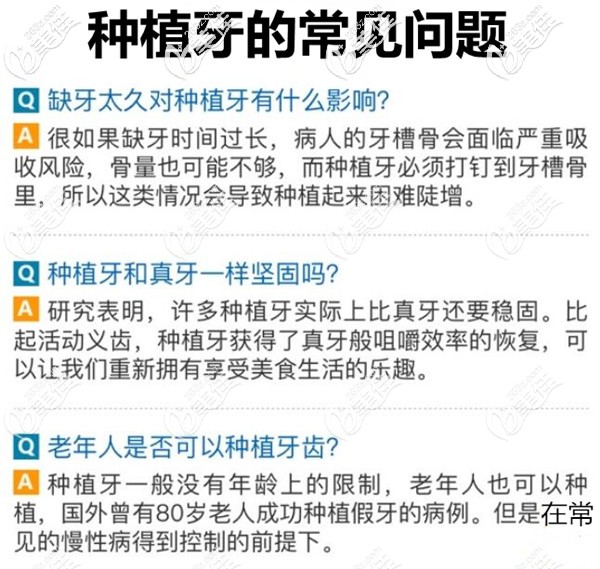 種植牙常見的問題 種植牙常見的問題