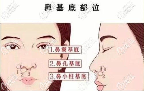 鼻基底的位置