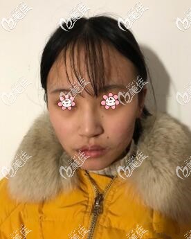 半個(gè)月以后 半個(gè)月以后