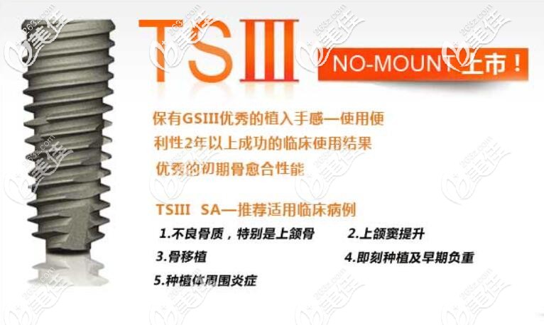 奧齒泰種植體怎么樣