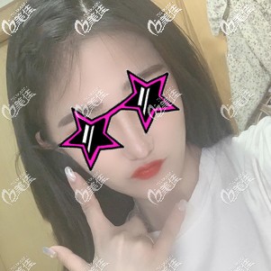 埋線提升術(shù)后3天下垂改善明顯 埋線提升術(shù)后3天下垂改善明顯