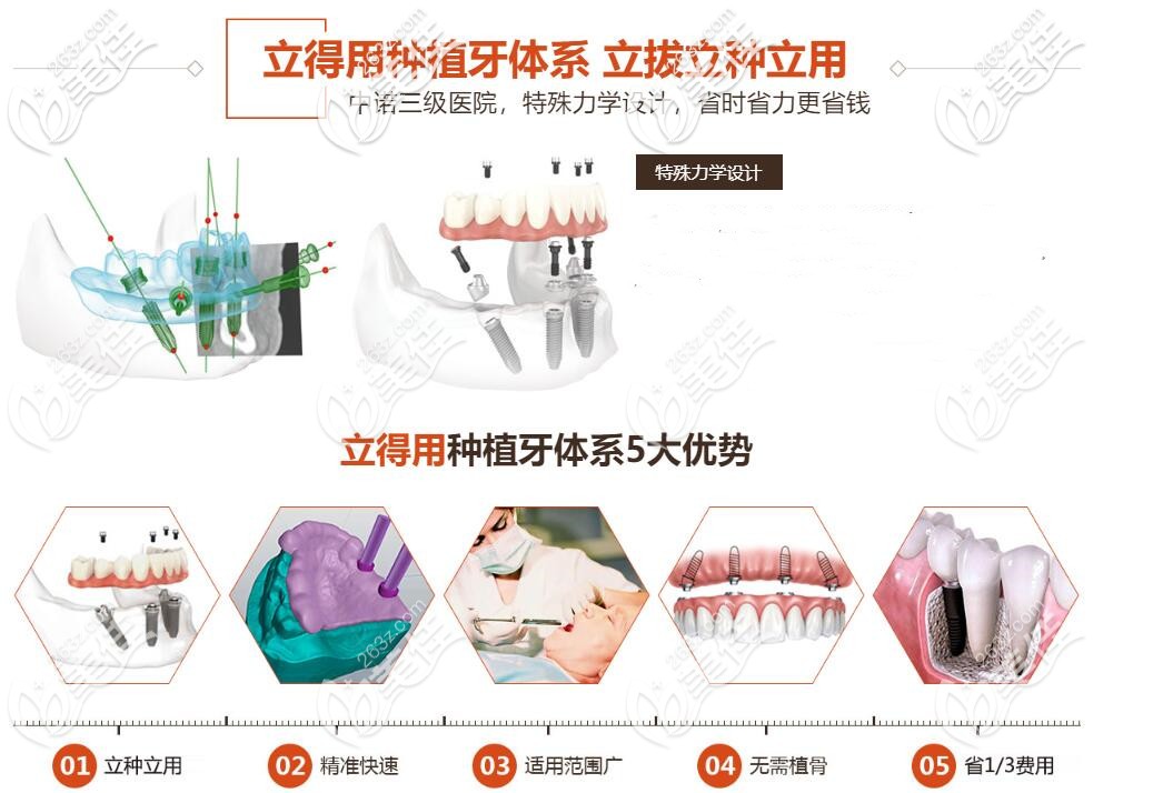 北京中諾口腔立得用種植牙特點(diǎn)