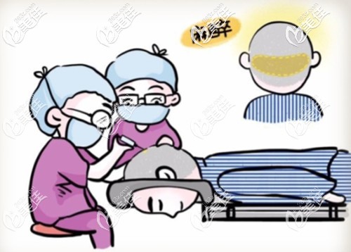 眉毛種植前需要局部麻木