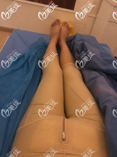 在淄博做吸脂手術(shù)后當(dāng)天