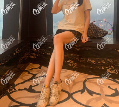 其實要想找到淄博哪家醫(yī)院做大腿吸脂手術技術好還蠻難的，還好我幸運