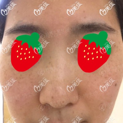 這是滿臉雀斑的我 這是滿臉雀斑的我