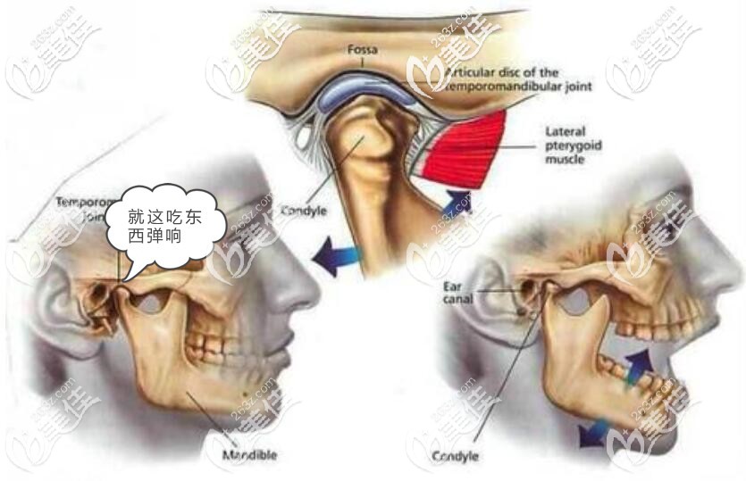 前牙深覆蓋不矯正會怎么樣 前牙深覆蓋不矯正會怎么樣