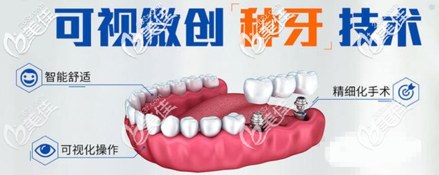 微創(chuàng)種植牙技術(shù) 微創(chuàng)種植牙技術(shù)
