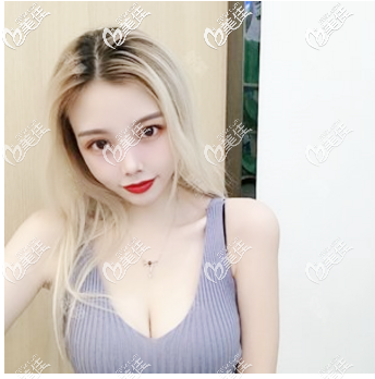 看我找許揚(yáng)濱做的隆胸效果怎么樣 看我找許揚(yáng)濱做的隆胸效果怎么樣