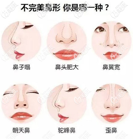 不同鼻子形態(tài) 不同鼻子形態(tài)