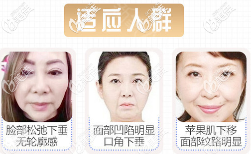 v美減齡適應(yīng)人群