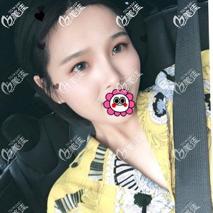 肋軟骨隆鼻恢復(fù)一個(gè)月<span style= 肋軟骨隆鼻恢復(fù)一個(gè)月<span style=