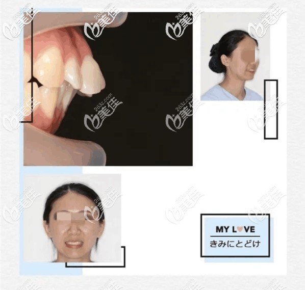 杭州美奧口腔門診部張彼得術(shù)前照片1