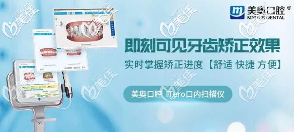 美奧口腔iTero口內(nèi)掃描儀 美奧口腔iTero口內(nèi)掃描儀