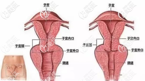 谷春霞醫(yī)生擅長(zhǎng)做陰道緊縮術(shù)