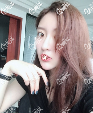 恢復(fù)差不多了