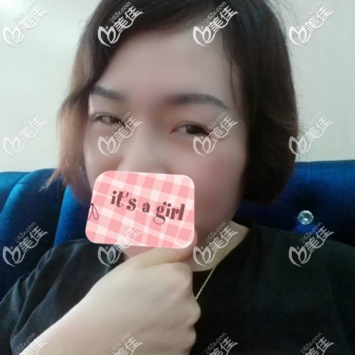 眉毛種植術后2個月進入脫落期 眉毛種植術后2個月進入脫落期