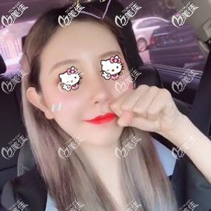 臉上肉多是吸脂好還是打溶脂針好？到醫(yī)院面診后醫(yī)生說還是做面部吸脂好一點