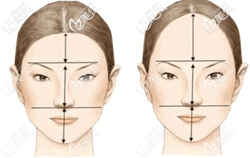 發(fā)際線后移非常影響顏值