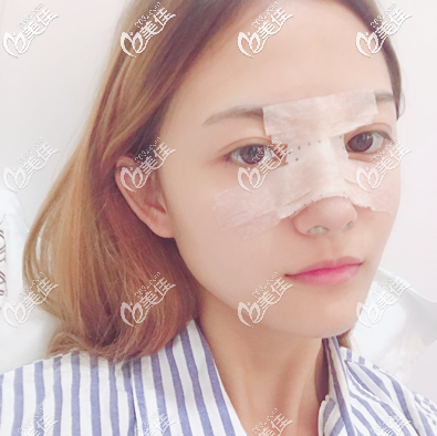 佛山順德壹加壹整形醫(yī)院隆鼻很靠譜