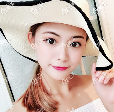 佛山隆鼻哪家醫(yī)院好，我推薦佛山順德壹加壹整形醫(yī)院