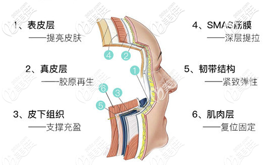 楚向杰6D長鈍針液態(tài)拉提術(shù) 楚向杰6D長鈍針液態(tài)拉提術(shù)