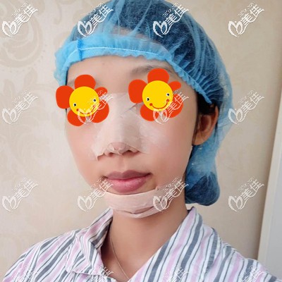 做完手術(shù)第3天效果