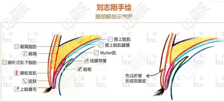 眼睛手術(shù)的部位 眼睛手術(shù)的部位